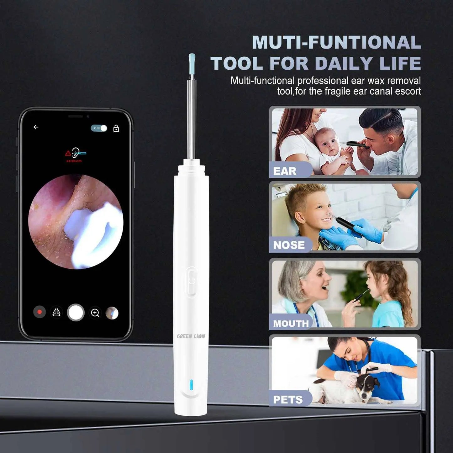 Green Lion Visual Earwax Removal Tool